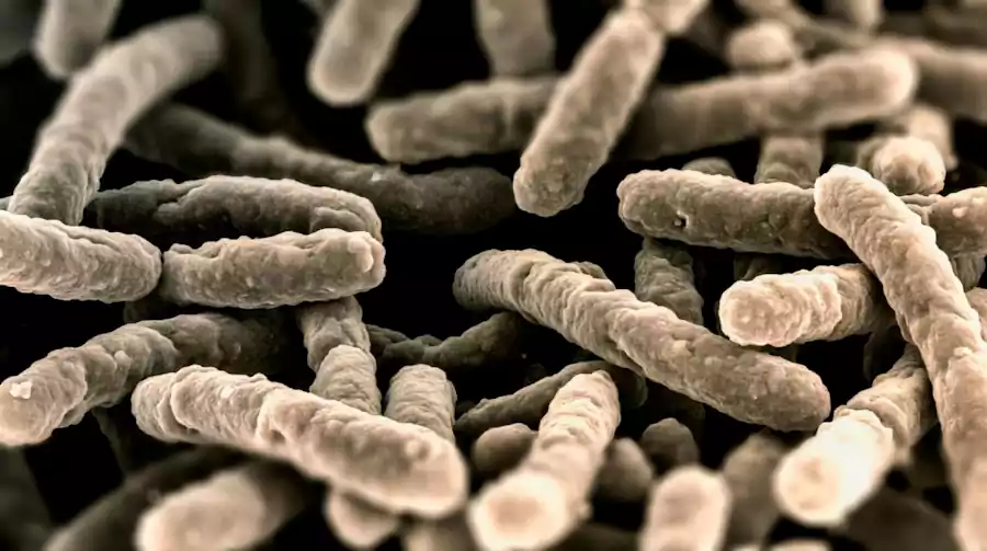 What Is Kimchi? Korea’s Most Famous Fermented Food 8 what is kimchi_korean kimchi7_Health Benefits